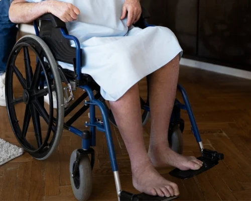 Paralysis